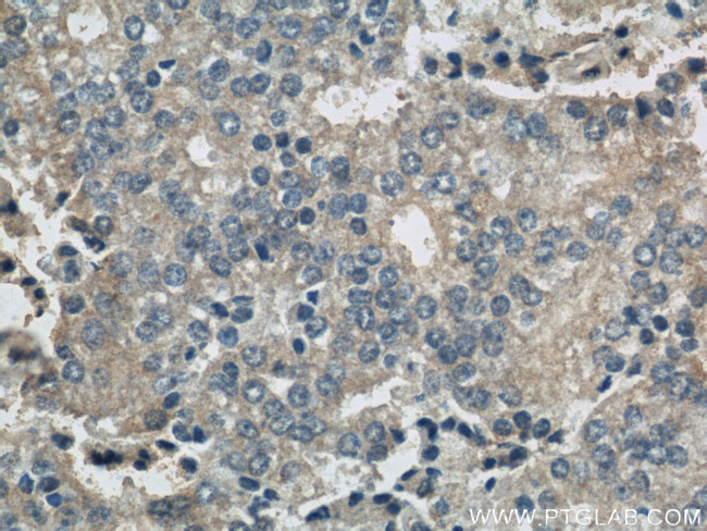 BLVRA Antibody in Immunohistochemistry (Paraffin) (IHC (P))