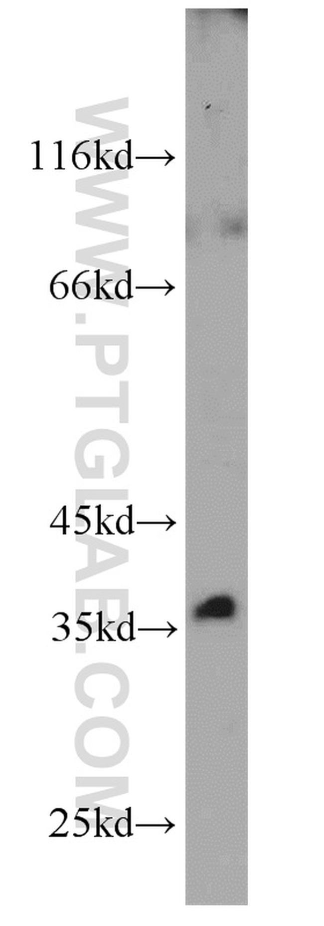 BLVRA Antibody in Western Blot (WB)