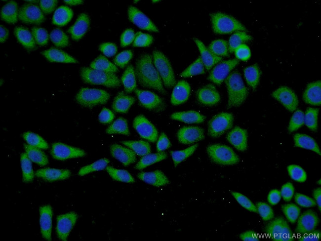 BLVRA Antibody in Immunocytochemistry (ICC/IF)