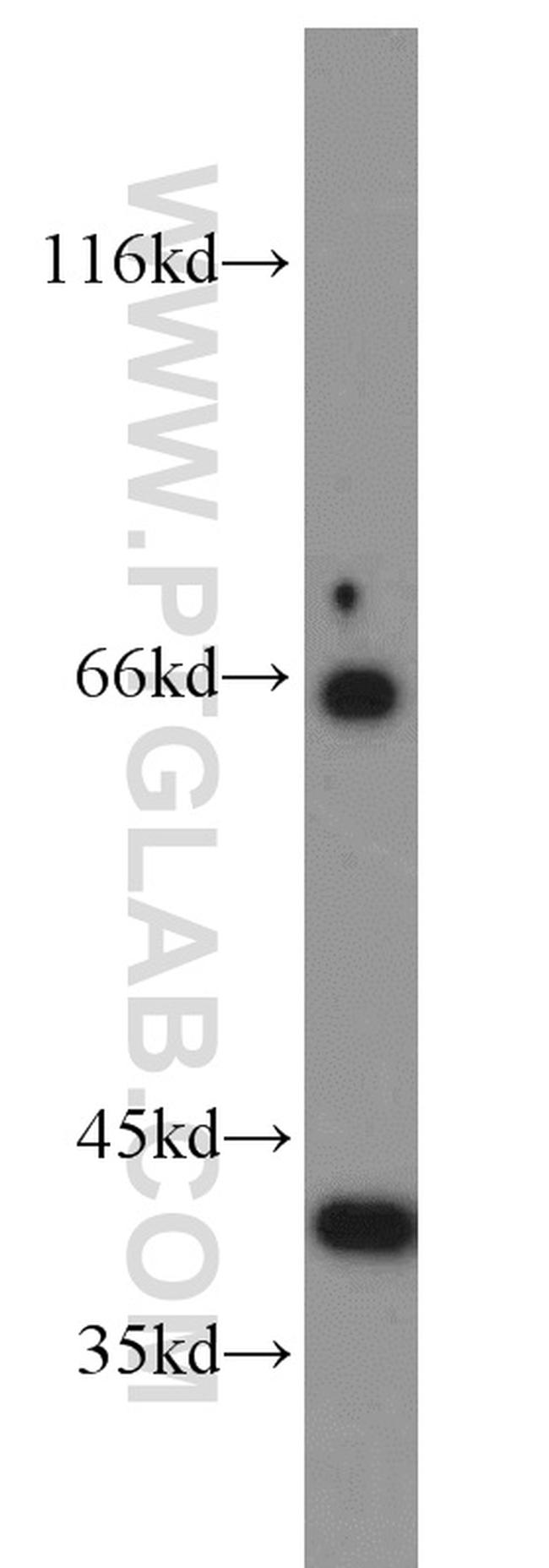 BLVRA Antibody in Western Blot (WB)