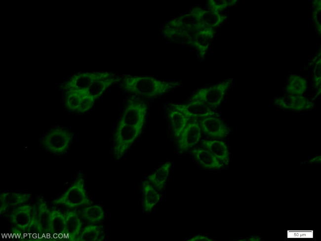 Dopamine beta Hydroxylase Antibody in Immunocytochemistry (ICC/IF)