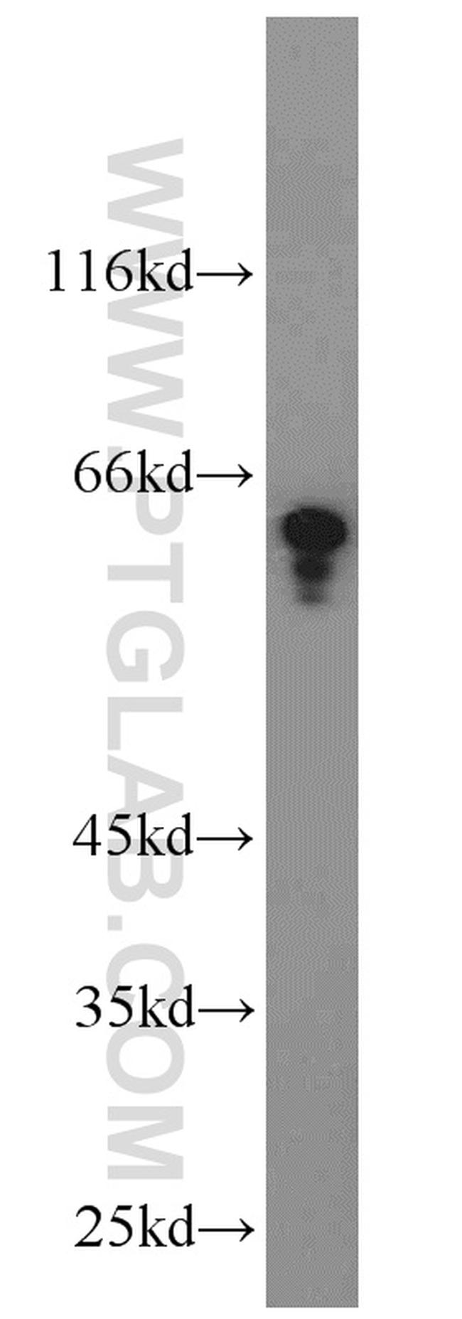 Dopamine beta Hydroxylase Antibody in Western Blot (WB)