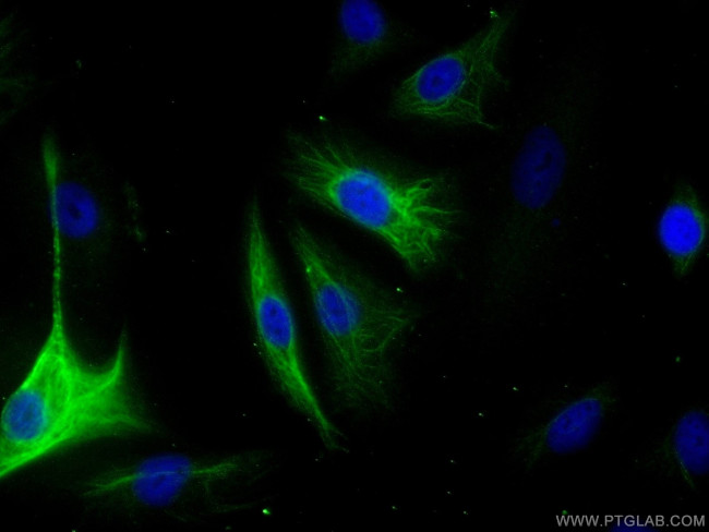 Adrenomedullin Antibody in Immunocytochemistry (ICC/IF)