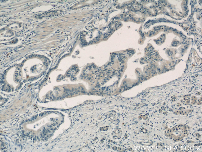 Adrenomedullin Antibody in Immunohistochemistry (Paraffin) (IHC (P))