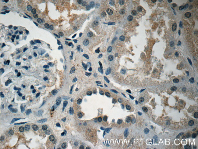 Adrenomedullin Antibody in Immunohistochemistry (Paraffin) (IHC (P))