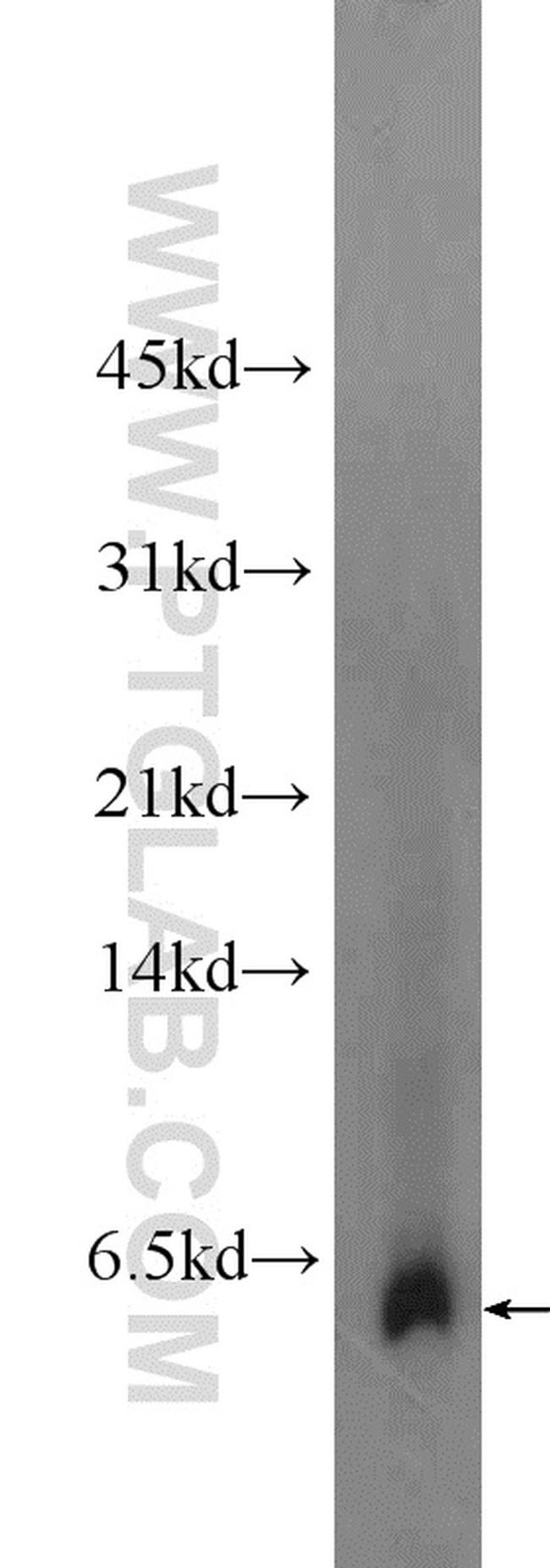 Adrenomedullin Antibody in Western Blot (WB)