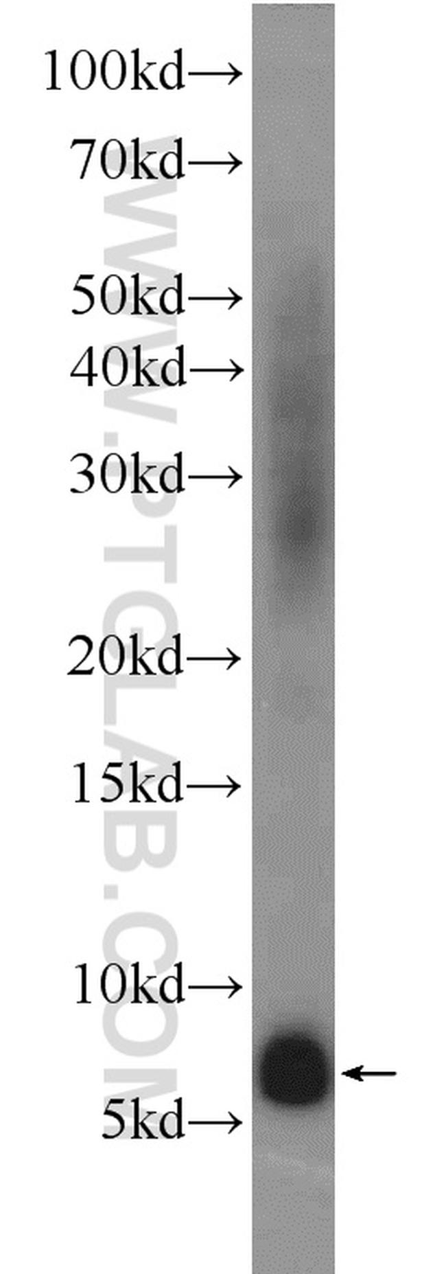 Adrenomedullin Antibody in Western Blot (WB)