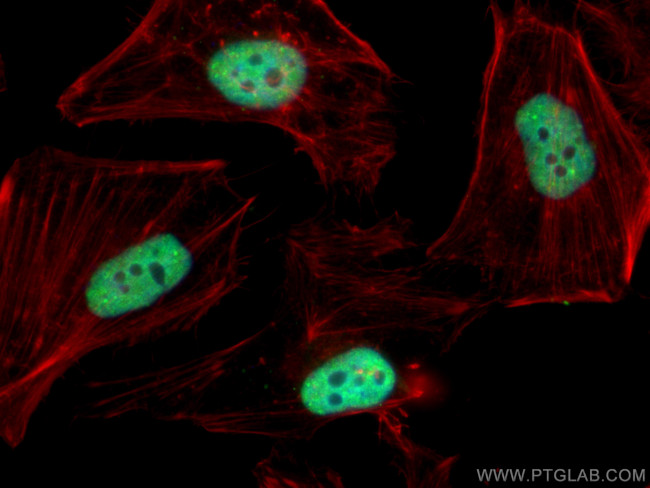 TDP-43 Antibody in Immunocytochemistry (ICC/IF)