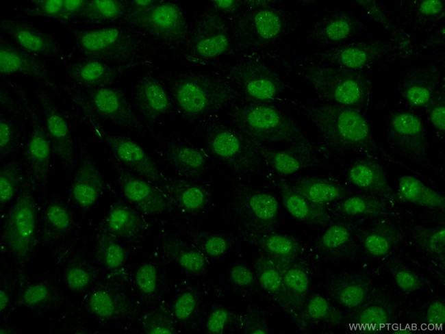 TDP-43 Antibody in Immunocytochemistry (ICC/IF)