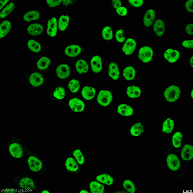 TDP-43 Antibody in Immunocytochemistry (ICC/IF)