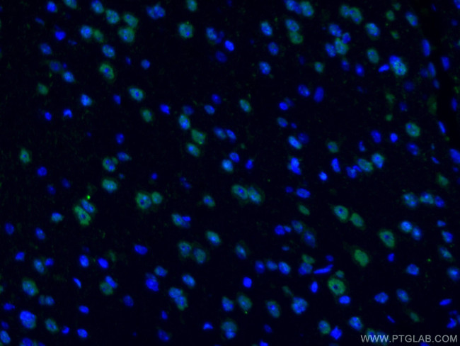 TDP-43 Antibody in Immunohistochemistry (PFA fixed) (IHC (PFA))