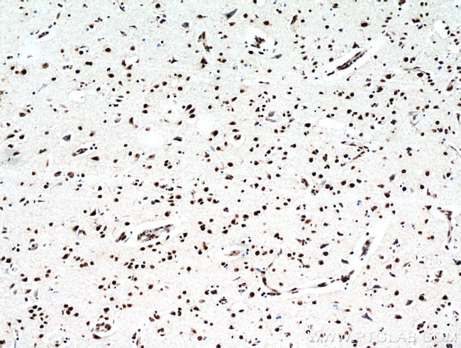 TDP-43 Antibody in Immunohistochemistry (Paraffin) (IHC (P))