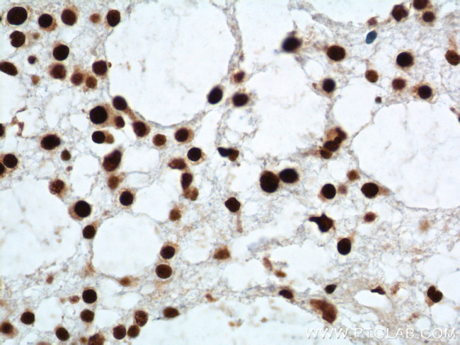 TDP-43 Antibody in Immunohistochemistry (Paraffin) (IHC (P))