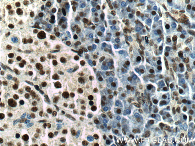 TDP-43 Antibody in Immunohistochemistry (Paraffin) (IHC (P))