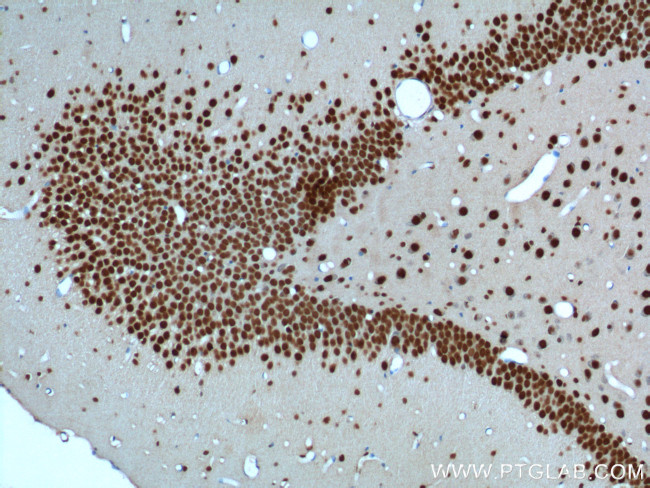 TDP-43 Antibody in Immunohistochemistry (Paraffin) (IHC (P))