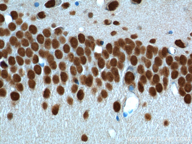 TDP-43 Antibody in Immunohistochemistry (Paraffin) (IHC (P))