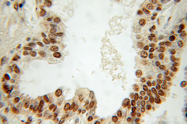 TDP-43 Antibody in Immunohistochemistry (Paraffin) (IHC (P))