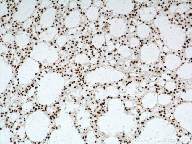 TDP-43 Antibody in Immunohistochemistry (Paraffin) (IHC (P))