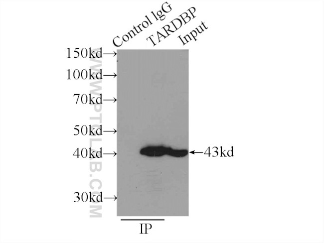 TDP-43 Antibody in Immunoprecipitation (IP)