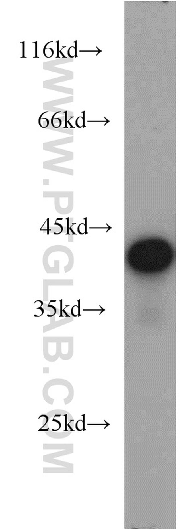 TDP-43 Antibody in Western Blot (WB)