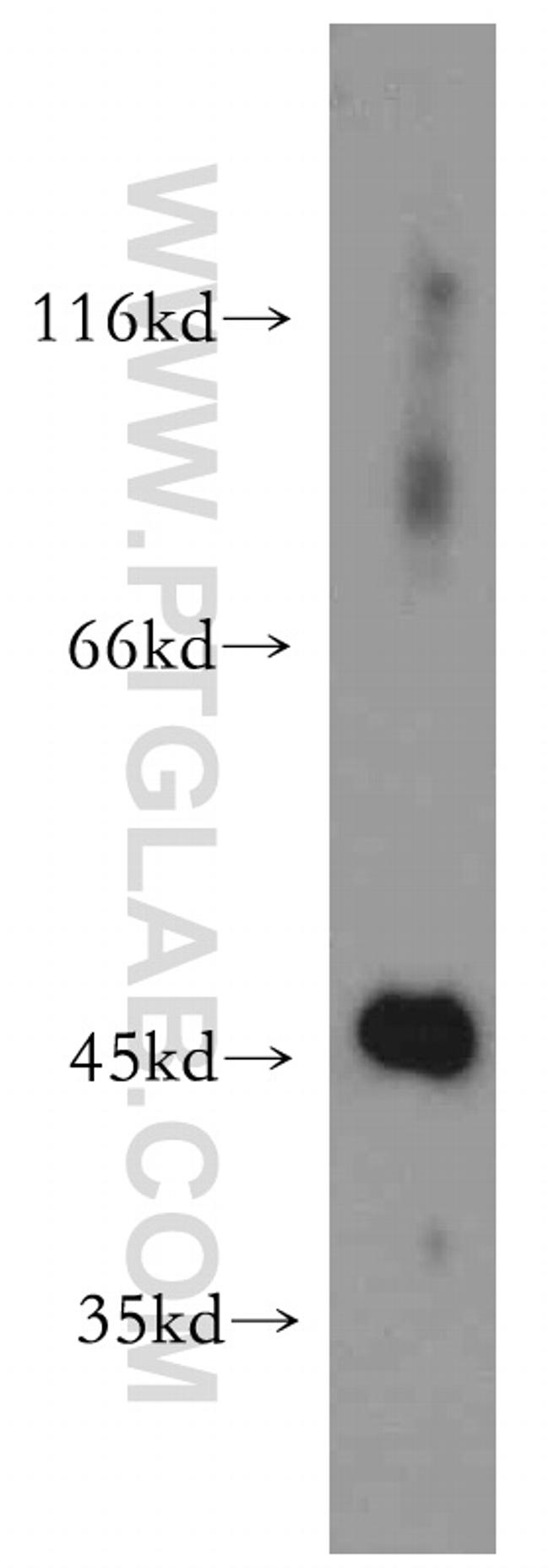 TDP-43 Antibody in Western Blot (WB)