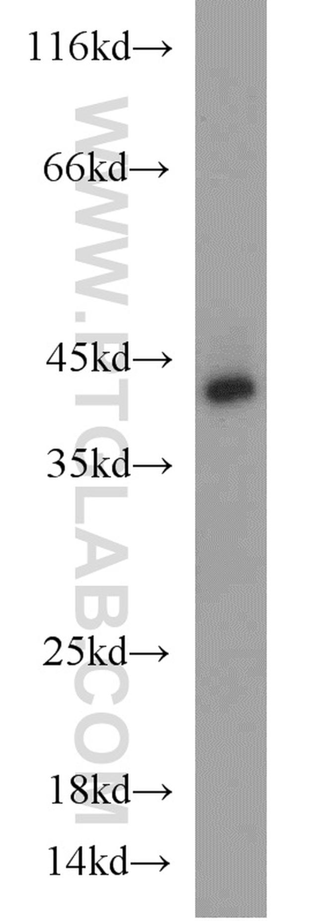 TDP-43 Antibody in Western Blot (WB)