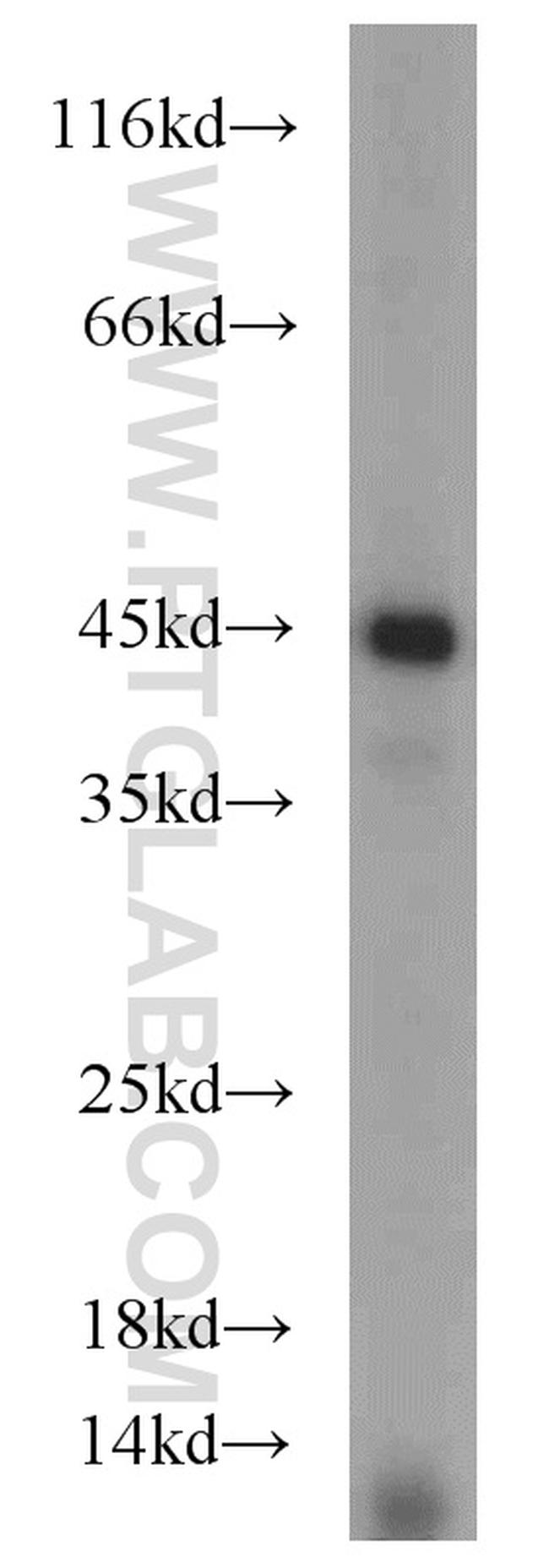 TDP-43 Antibody in Western Blot (WB)