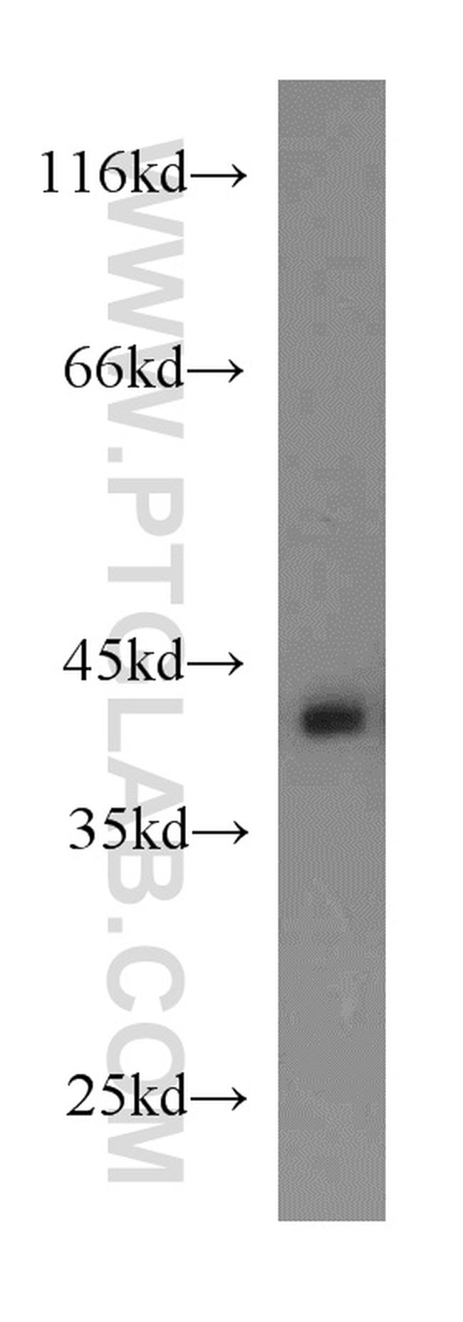 TDP-43 Antibody in Western Blot (WB)