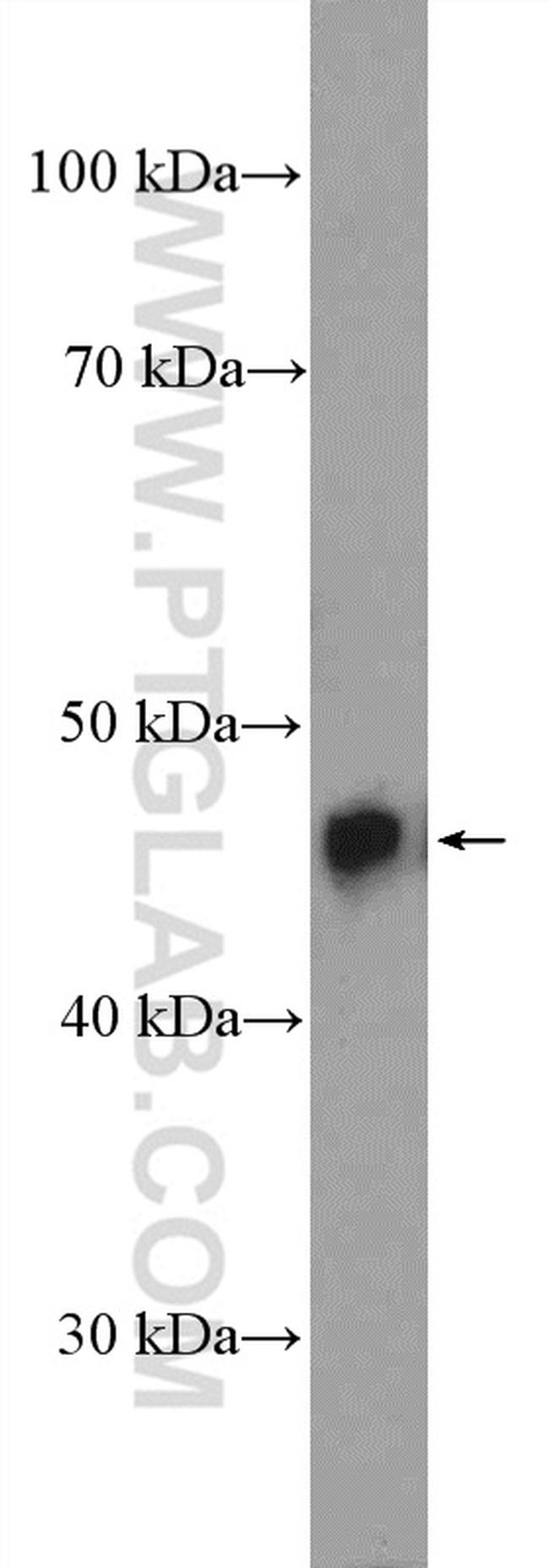 TDP-43 Antibody in Western Blot (WB)