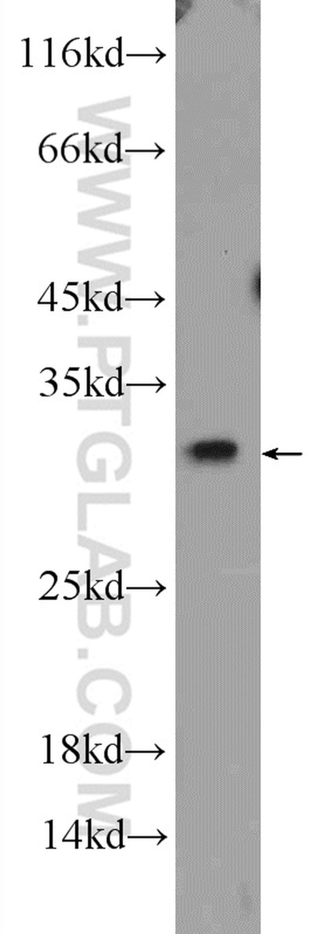 Bcl-XL Antibody in Western Blot (WB)