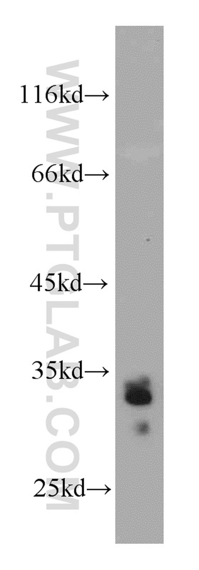 Bcl-XL Antibody in Western Blot (WB)