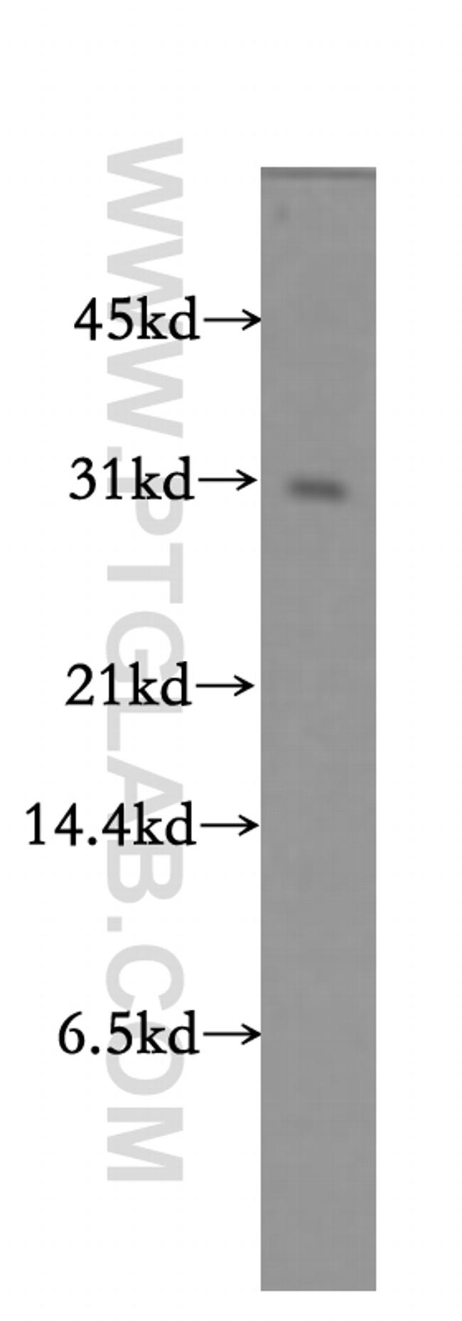 Bcl-XL Antibody in Western Blot (WB)