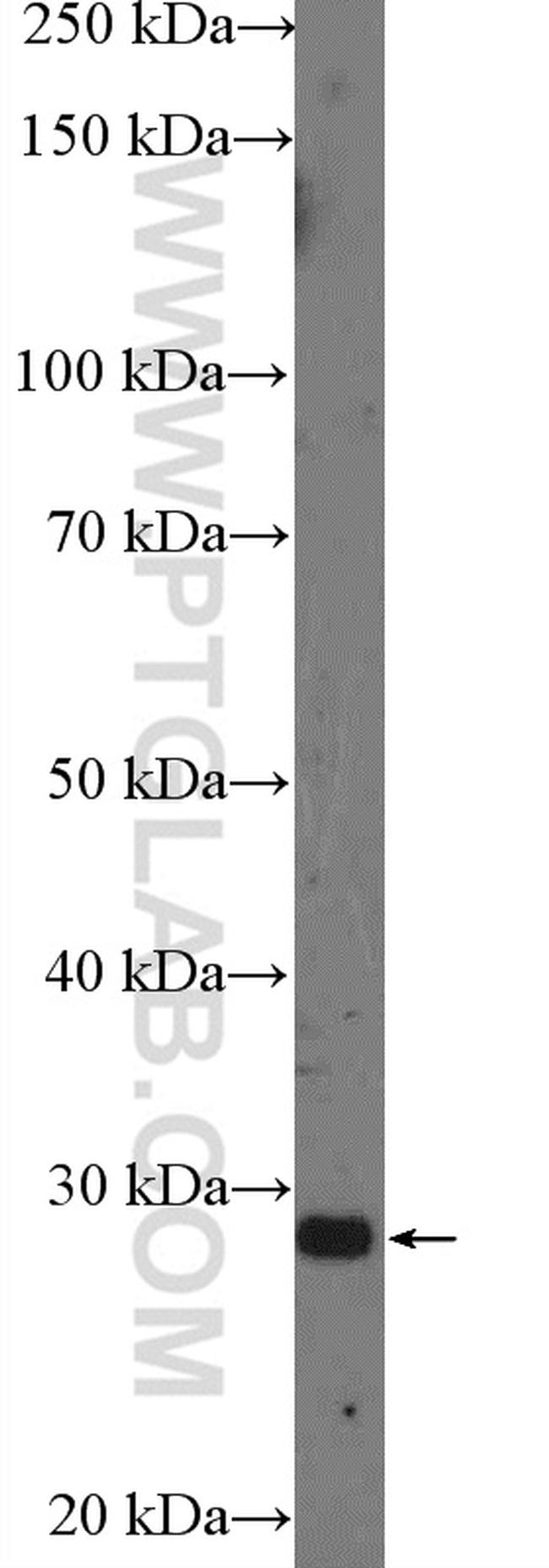 Bcl-XL Antibody in Western Blot (WB)