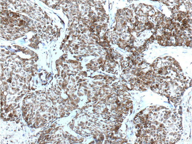 Bcl-XL Antibody in Immunohistochemistry (Paraffin) (IHC (P))