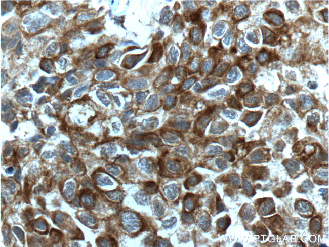 Bcl-XL Antibody in Immunohistochemistry (Paraffin) (IHC (P))