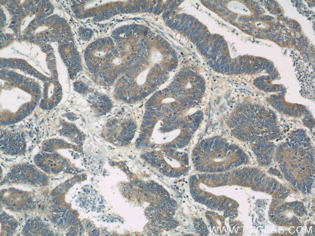 LDLR Antibody in Immunohistochemistry (Paraffin) (IHC (P))