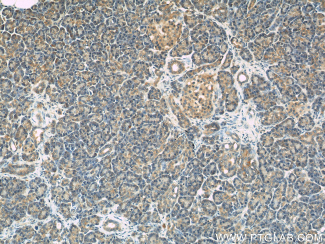 LDLR Antibody in Immunohistochemistry (Paraffin) (IHC (P))