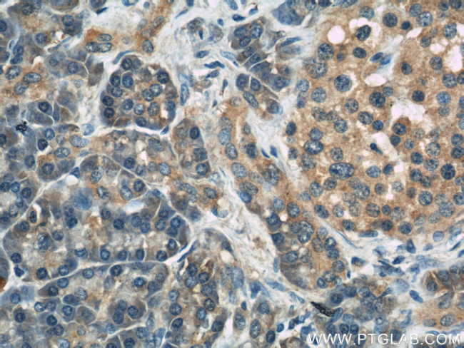 LDLR Antibody in Immunohistochemistry (Paraffin) (IHC (P))