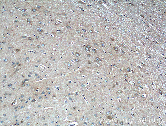 LDLR Antibody in Immunohistochemistry (Paraffin) (IHC (P))