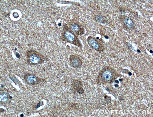 LDLR Antibody in Immunohistochemistry (Paraffin) (IHC (P))