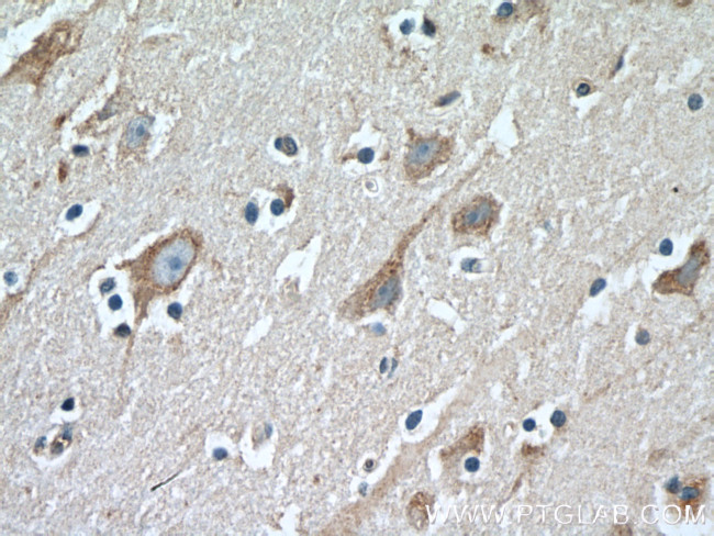 LDLR Antibody in Immunohistochemistry (Paraffin) (IHC (P))