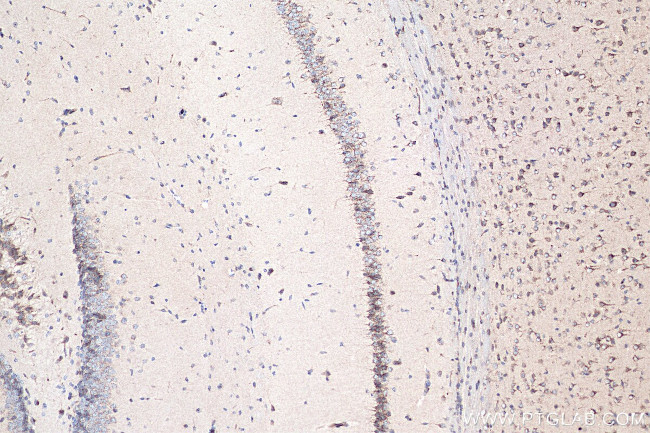 LDLR Antibody in Immunohistochemistry (Paraffin) (IHC (P))