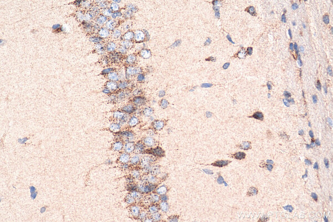 LDLR Antibody in Immunohistochemistry (Paraffin) (IHC (P))