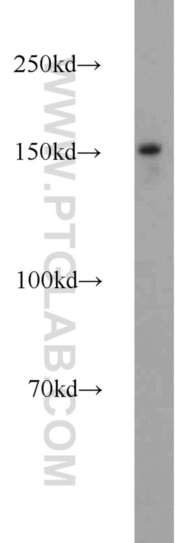 LDLR Antibody in Western Blot (WB)