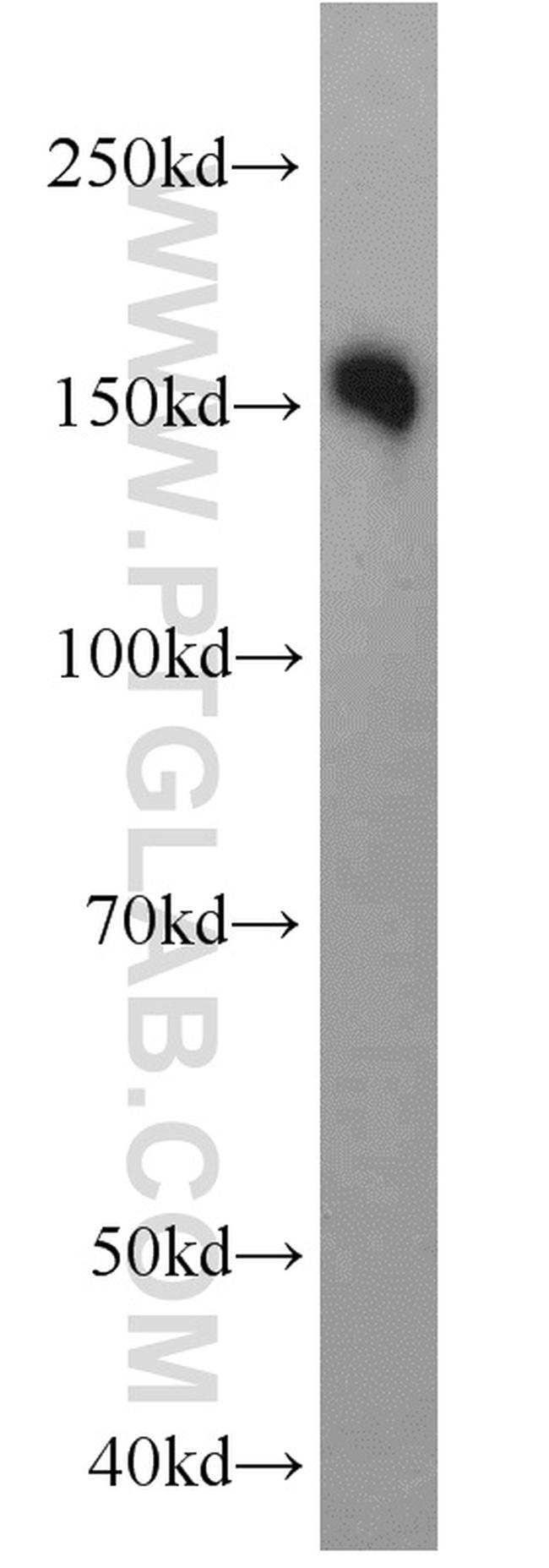 LDLR Antibody in Western Blot (WB)