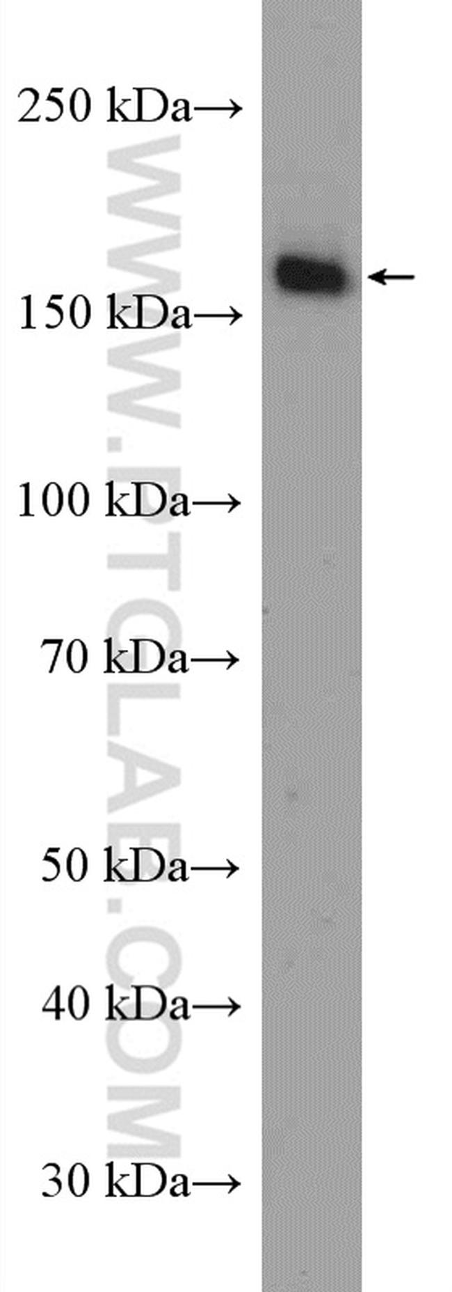 LDLR Antibody in Western Blot (WB)