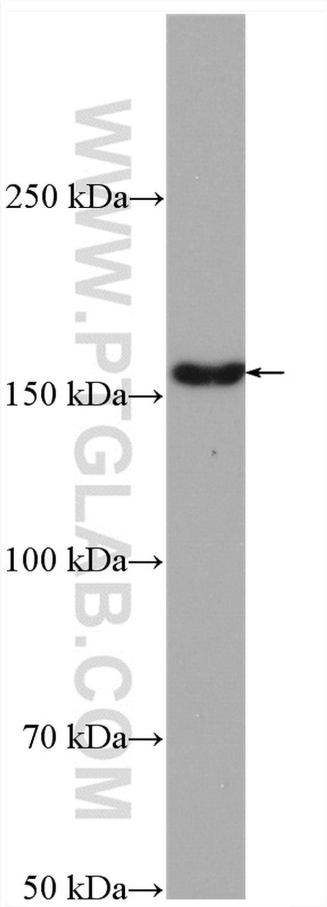 LDLR Antibody in Western Blot (WB)