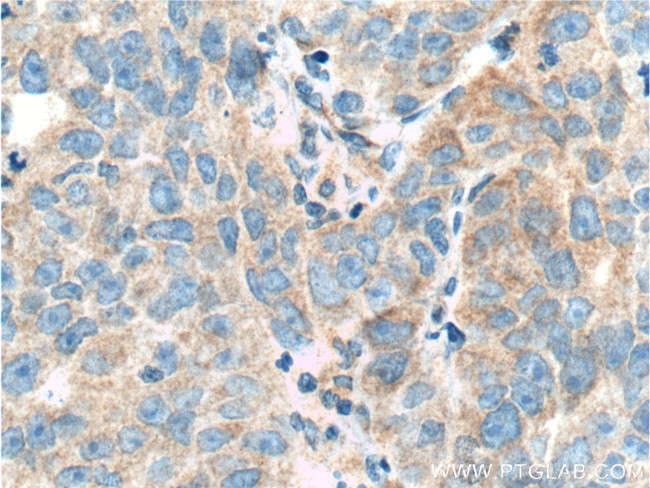 TRIM9 Antibody in Immunohistochemistry (Paraffin) (IHC (P))