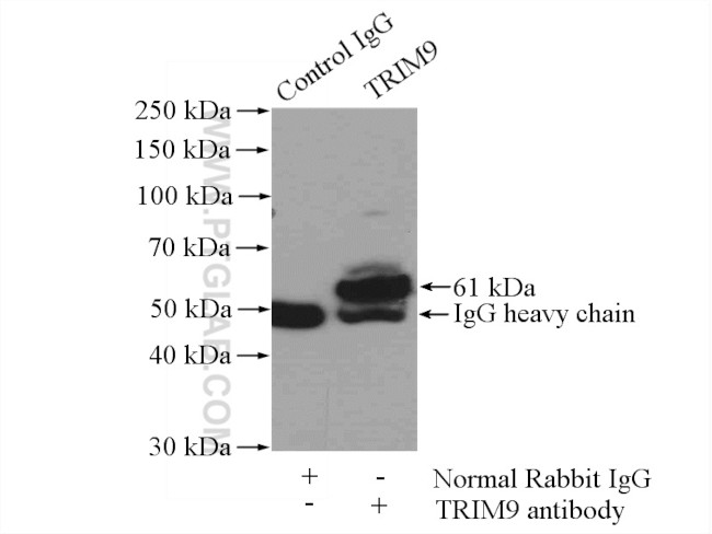 TRIM9 Antibody in Immunoprecipitation (IP)