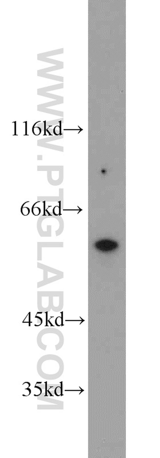 TRIM9 Antibody in Western Blot (WB)